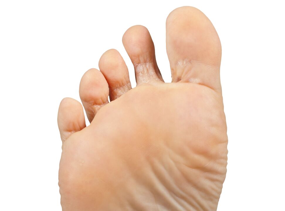 Funger-Good-and-and-leal-and-hectic-Cream-Demyxil