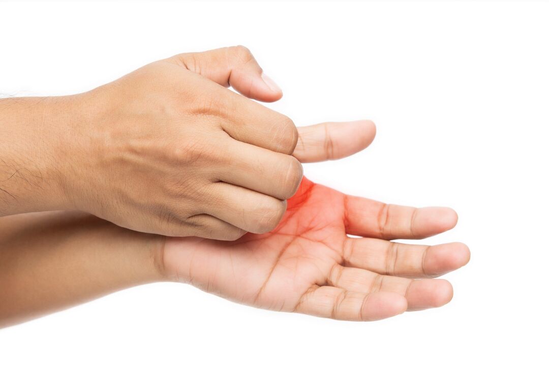 Itching with fungi and its treatment with demiixil cream